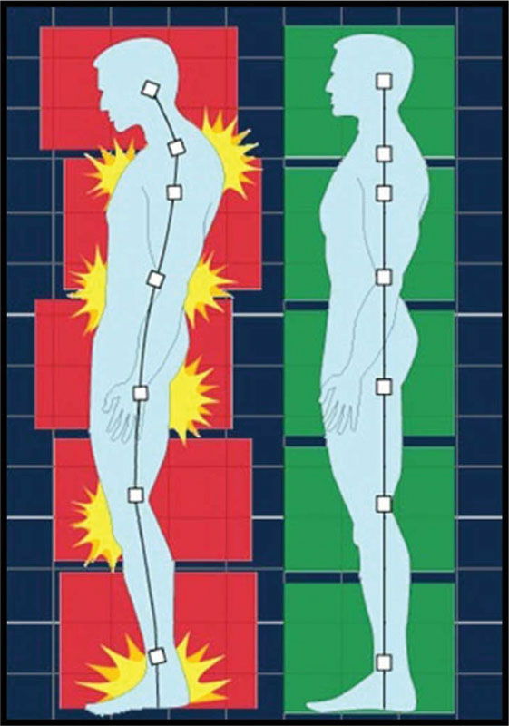 Stand Up Straight!! Your Body Posture is Giving You Clues