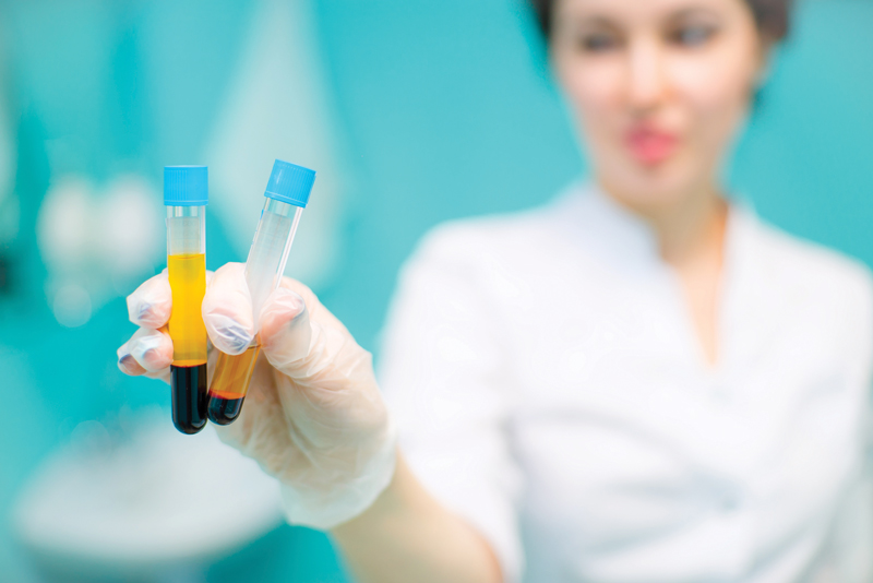 The Many Benefits of Platelet Rich Plasma