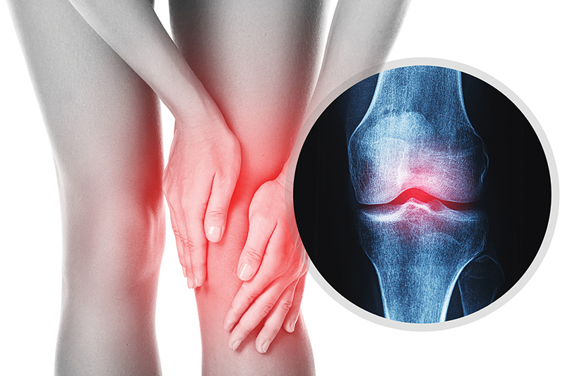 Why Your Knee Hurts, and What to Do About It