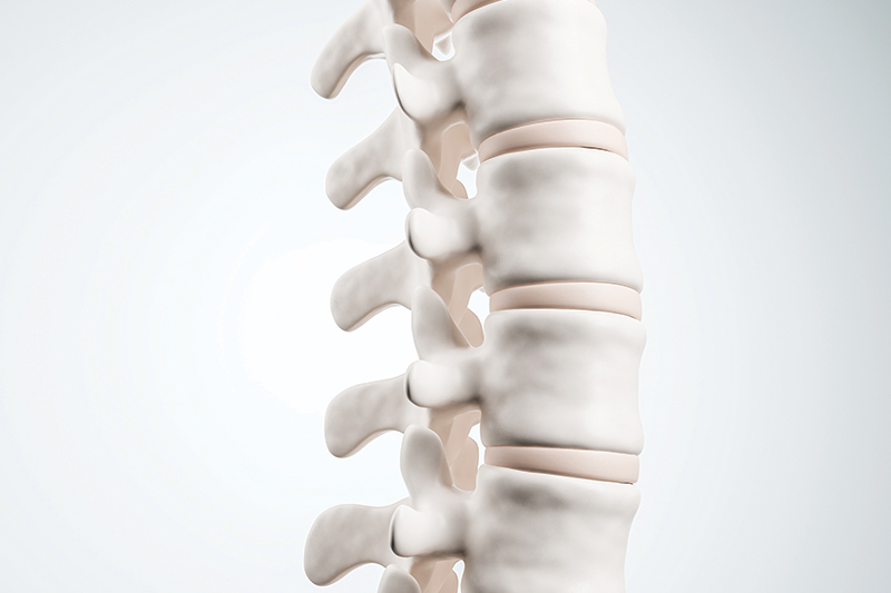 Herniated Discs DO NOT Cause Back Pain!