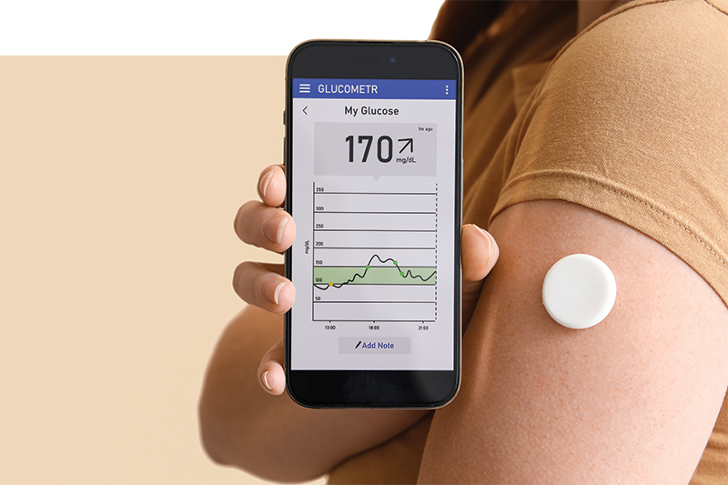 Does a Continuous Glucose Monitor Help Reverse Type 2 Diabetes?