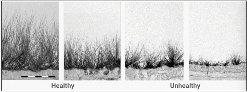 Glycocalyx #1